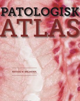 Patologisk atlas