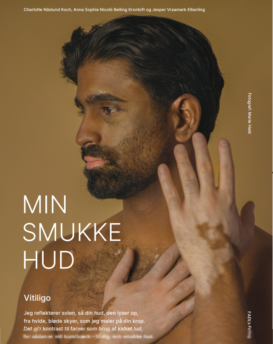 Plakat - Vitiligo uden ramme