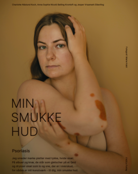 Plakat -  Psoriasis med ramme
